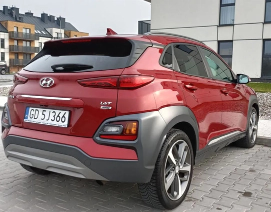 Hyundai Kona cena 81800 przebieg: 114700, rok produkcji 2020 z Gdańsk małe 137